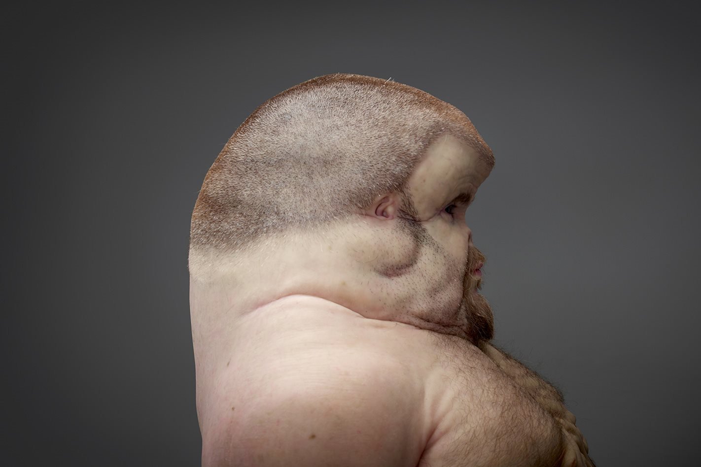 Graham TAC dummy